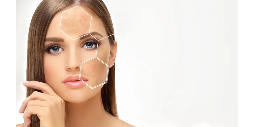 Mezoterapia: igłowa czy bezigłowa? Porównajmy skuteczność i wygodę