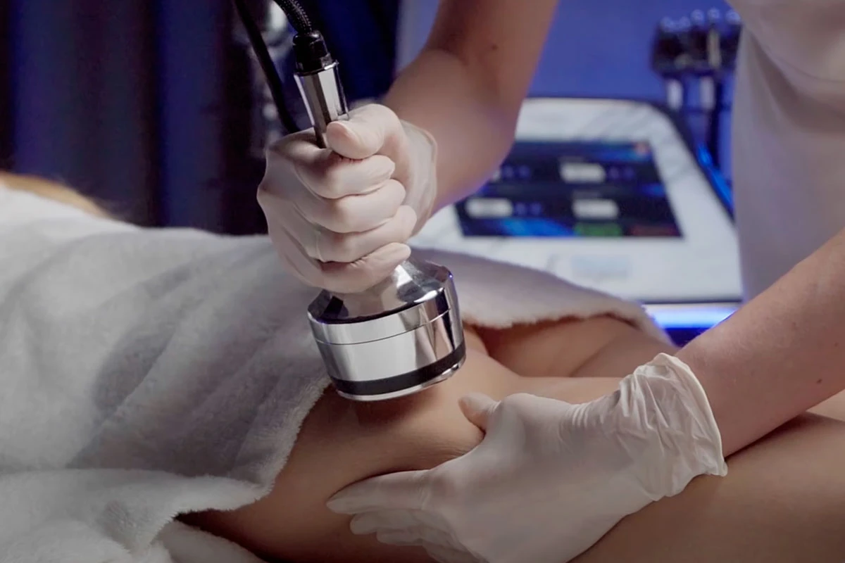 Rezultaty i trwałość efektu: czego mogą oczekiwać klienci