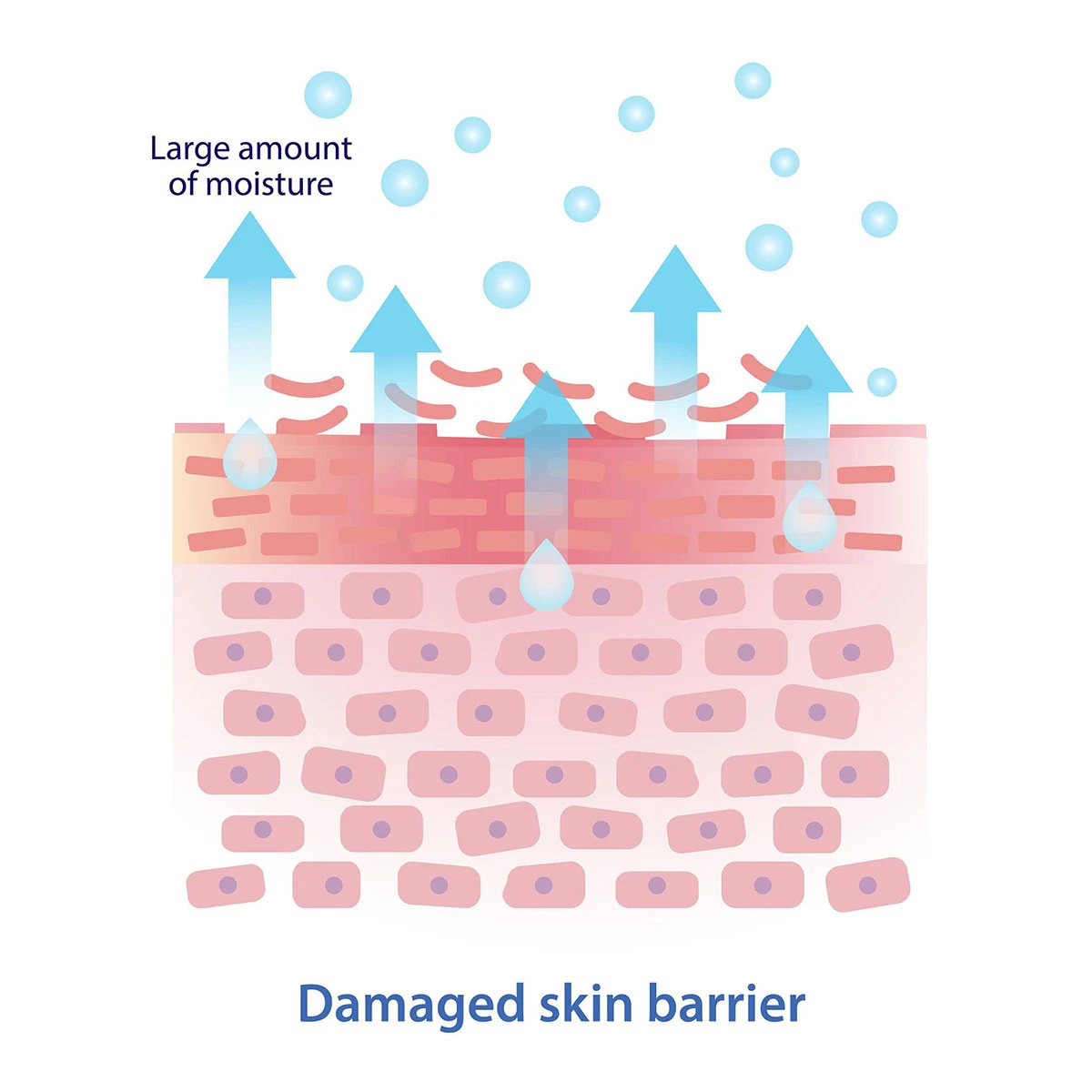 czym jest uszkodzona bariera skórna i dlaczego to problem