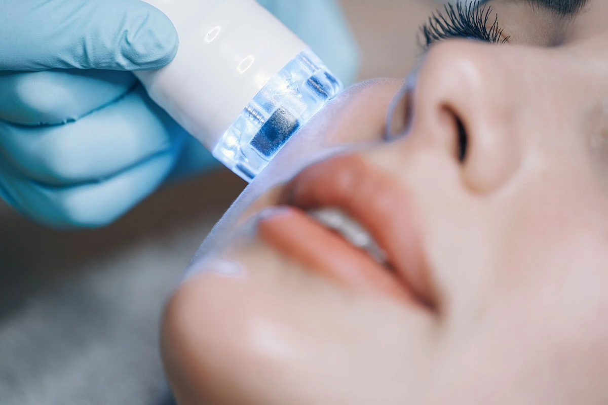 Co to jest hydradermabrazja