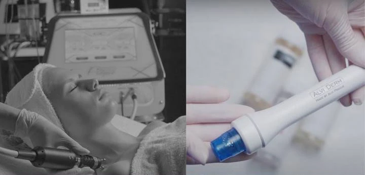 Delikatne zabiegi aparaturowe dla skóry wrażliwej i alergicznej