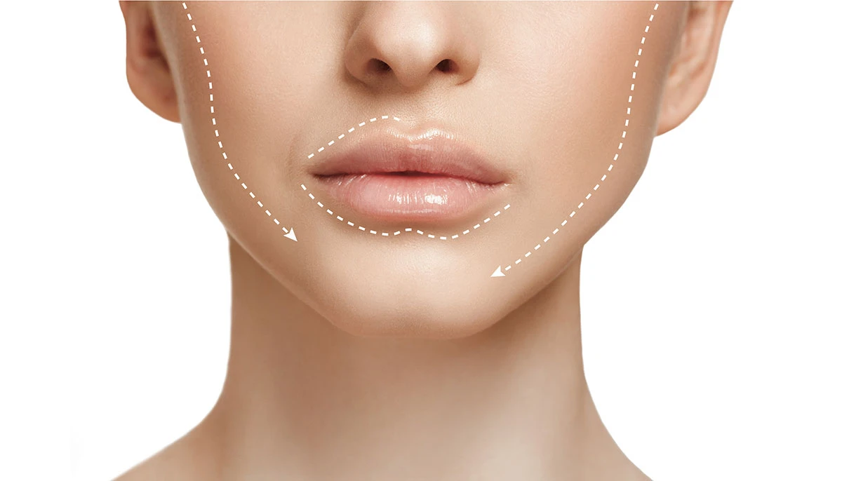 porównanie rf urządzenia do liftingu twarzy i HIFU