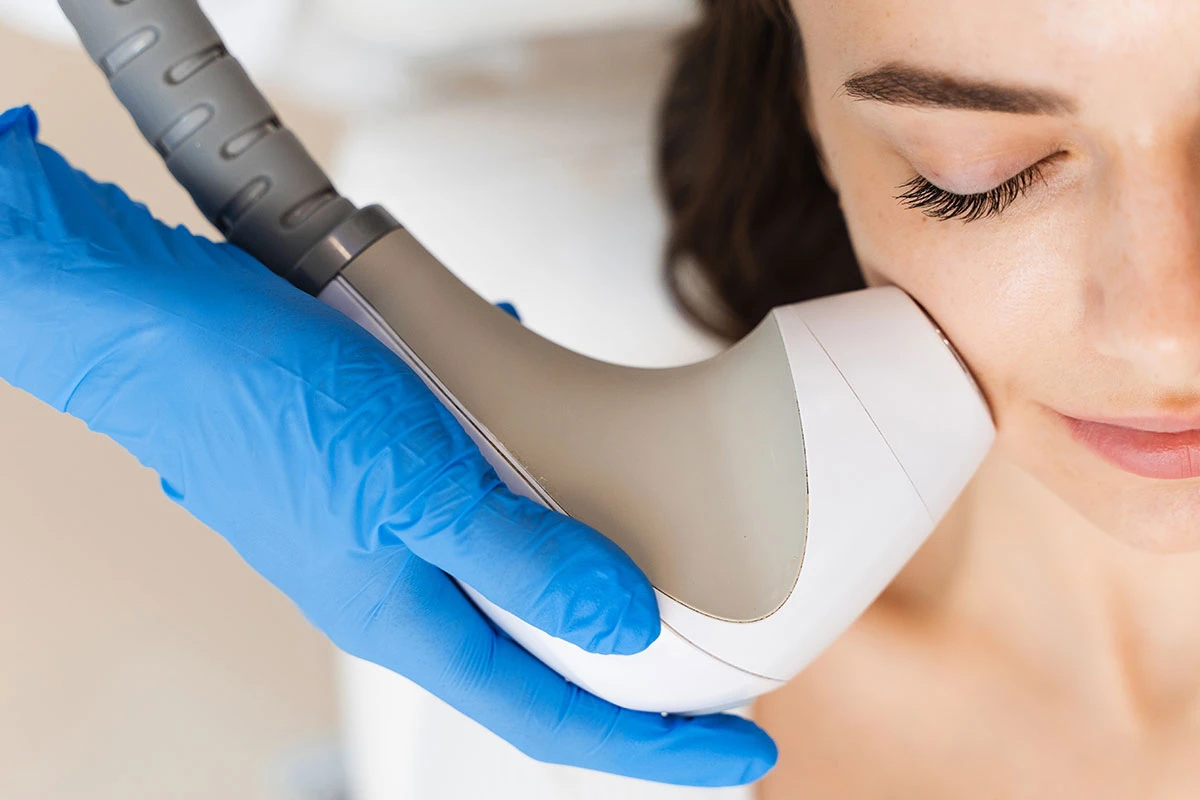 jak wybrać między rf urządzeniem do liftingu twarzy a HIFU