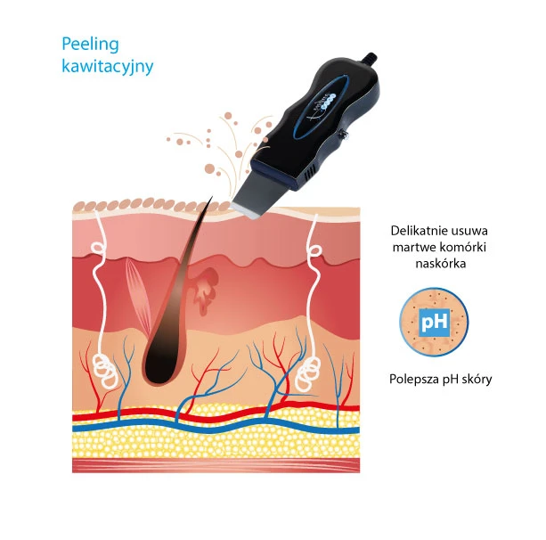Inne zalety urządzenia do peelingu kawitacyjnego T-02 alvi praha