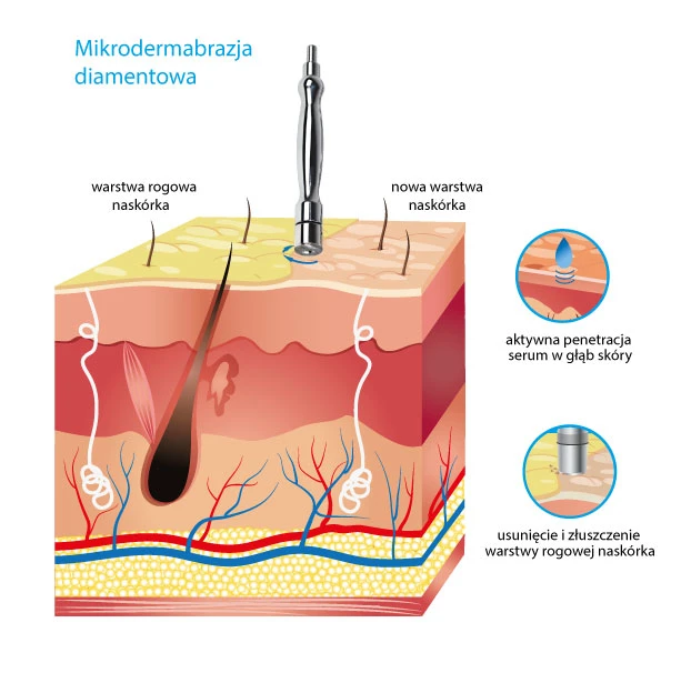 Kup Urządzenie do mikrodermabrazji diamentowej T-06 w sklepie internetowym Alvi Praga - Cena od producenta - Dostawa w Polsce