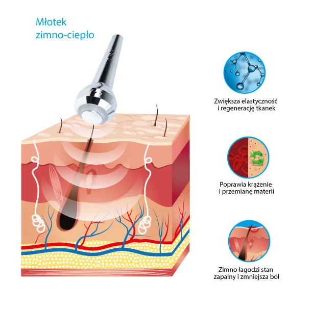 kosmetyczne młotek ciepło zimno t-05 terapia ciepło/zimno młotek ciepło zimno t-05 urządzenia jednofunkcyjny